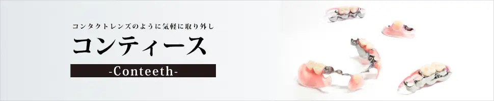コンティース